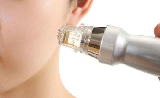 Fractional RF